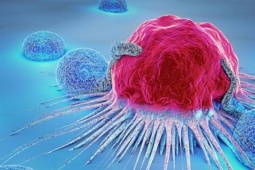 Thói quen âm thầm 'nuôi lớn' tế bào ung thư, nhiều người Việt đang mắc phải