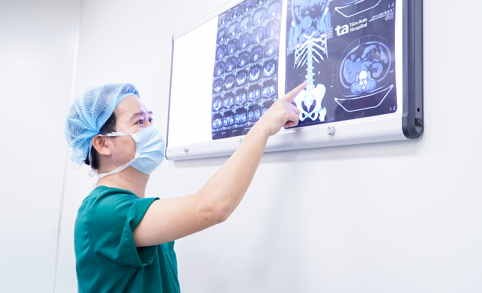 Hình chụp CT cho thấy bà Hoàng có sỏi thận hai bên và sỏi niệu quản phải. Ảnh: Bệnh viện Đa khoa Tâm Anh