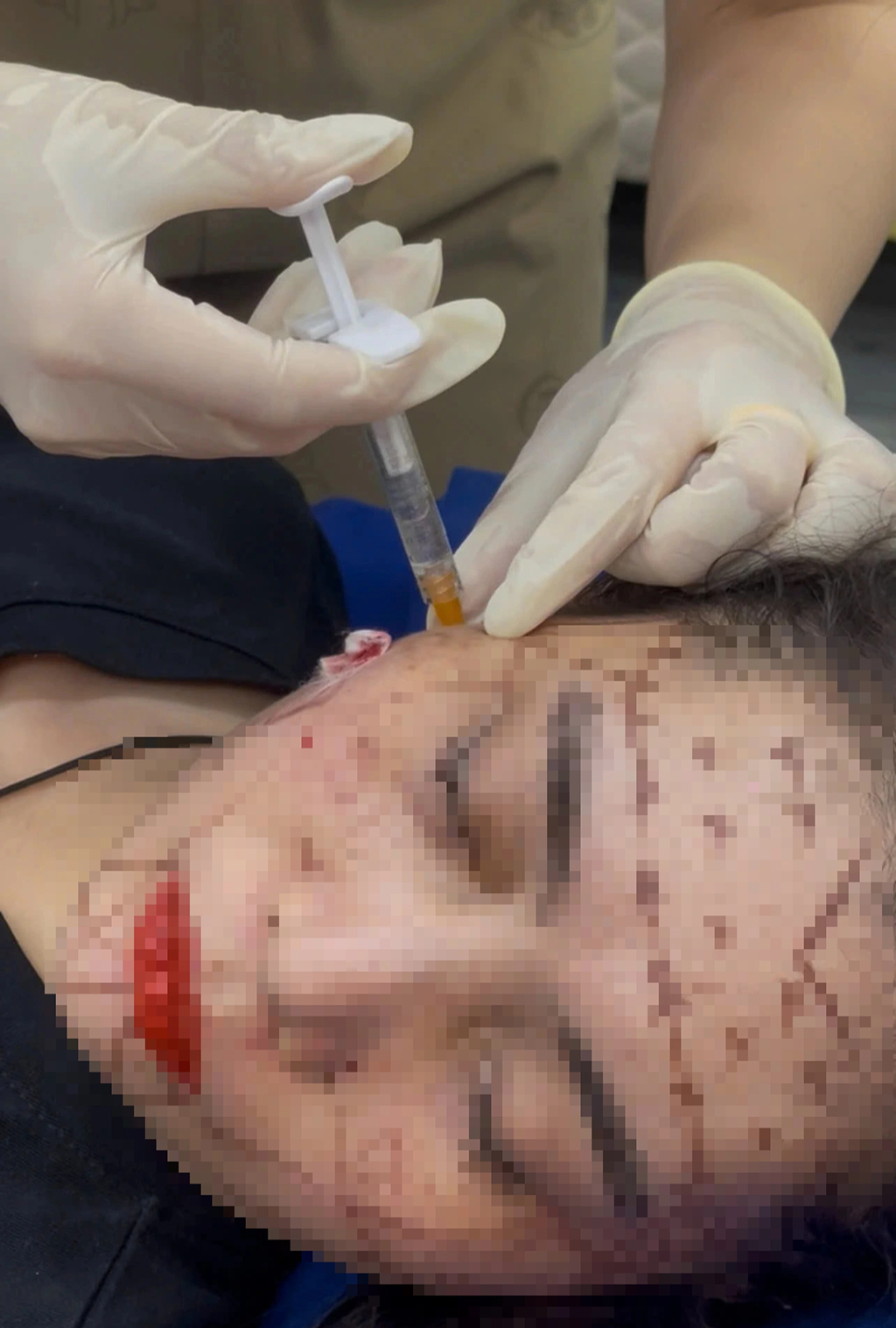 Thẩm mỹ chui tại tp . Hcm: Khám phá lò đào tạo bác sĩ không giấy phép năm 2026 - Ảnh 2. Thẩm mỹ chui tại tp . Hcm: Khám phá lò đào tạo bác sĩ không giấy phép năm 2026 - Ảnh 2.