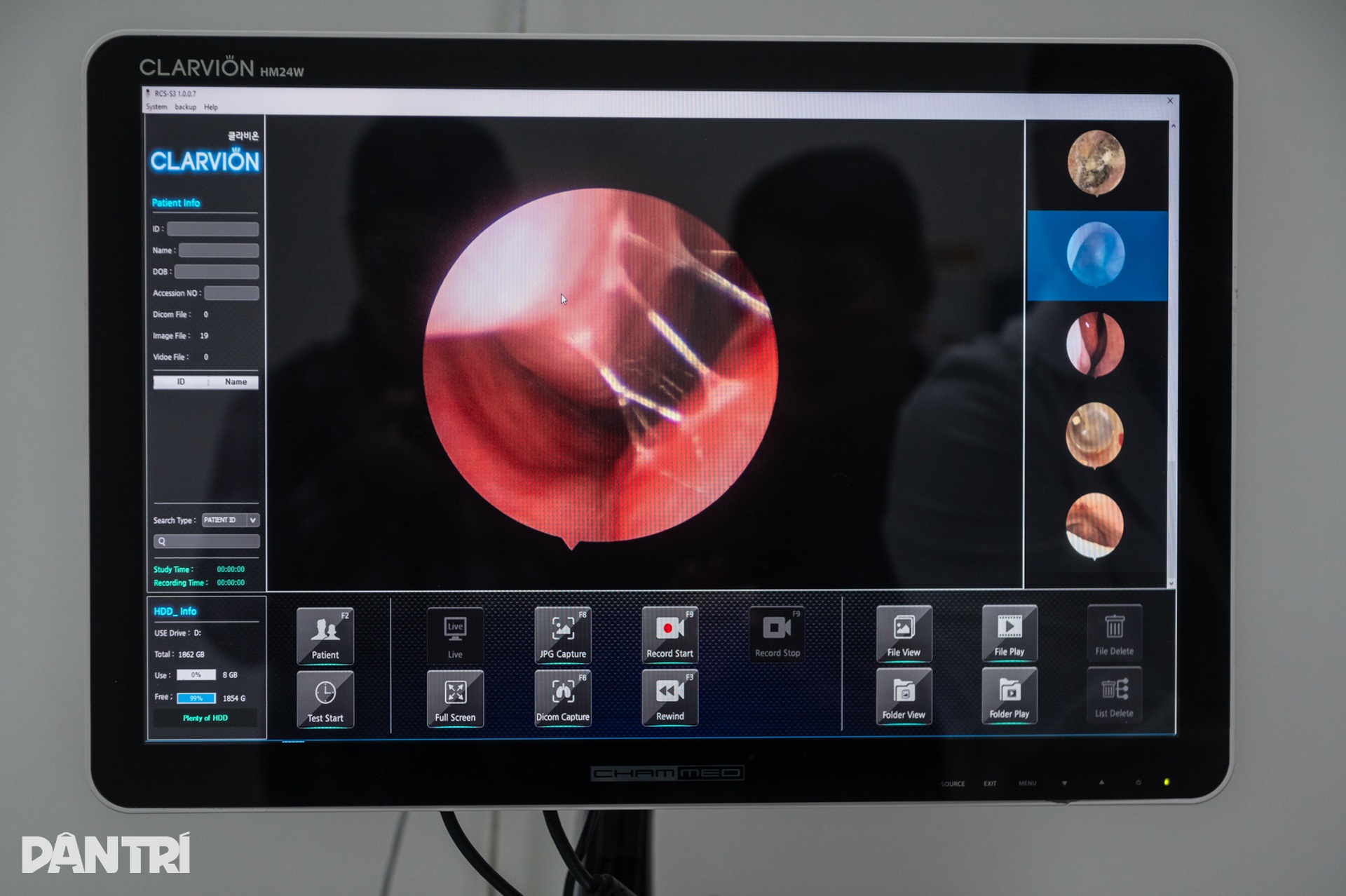 Bên trong khoang mũi sưng nề của người Hà Nội giữa cao điểm ô nhiễm - 9