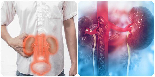 8 thói quen gây suy thận, người Việt cần biết để tránh 4 Ảnh minh họa.