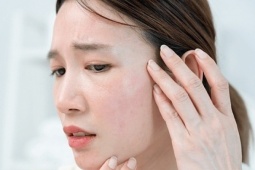 Thói quen khiến da khô nẻ dù thoa kem dưỡng ẩm thường xuyên