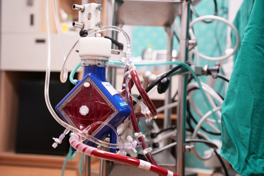 Đặt tim phổi nhân tạo cứu sống bệnh nhân ngừng tuần hoàn do ngạt khí độc - 2
