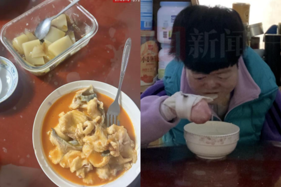 Từng bị chẩn đoán không sống quá 2 tuổi, “cô gái bươm bướm” hiện tại ra sao ở tuổi 25?- Ảnh 2.