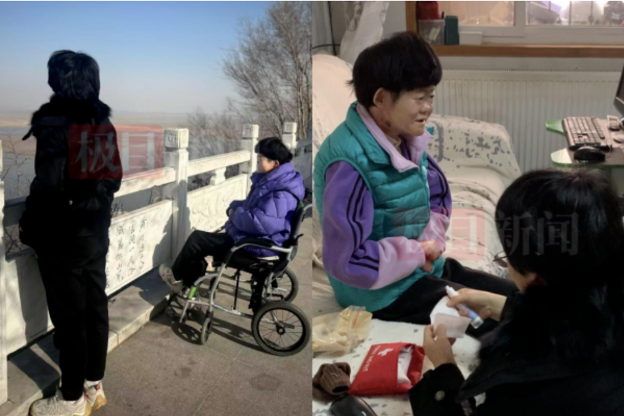 Từng bị chẩn đoán không sống quá 2 tuổi, “cô gái bươm bướm” hiện tại ra sao ở tuổi 25?- Ảnh 3.