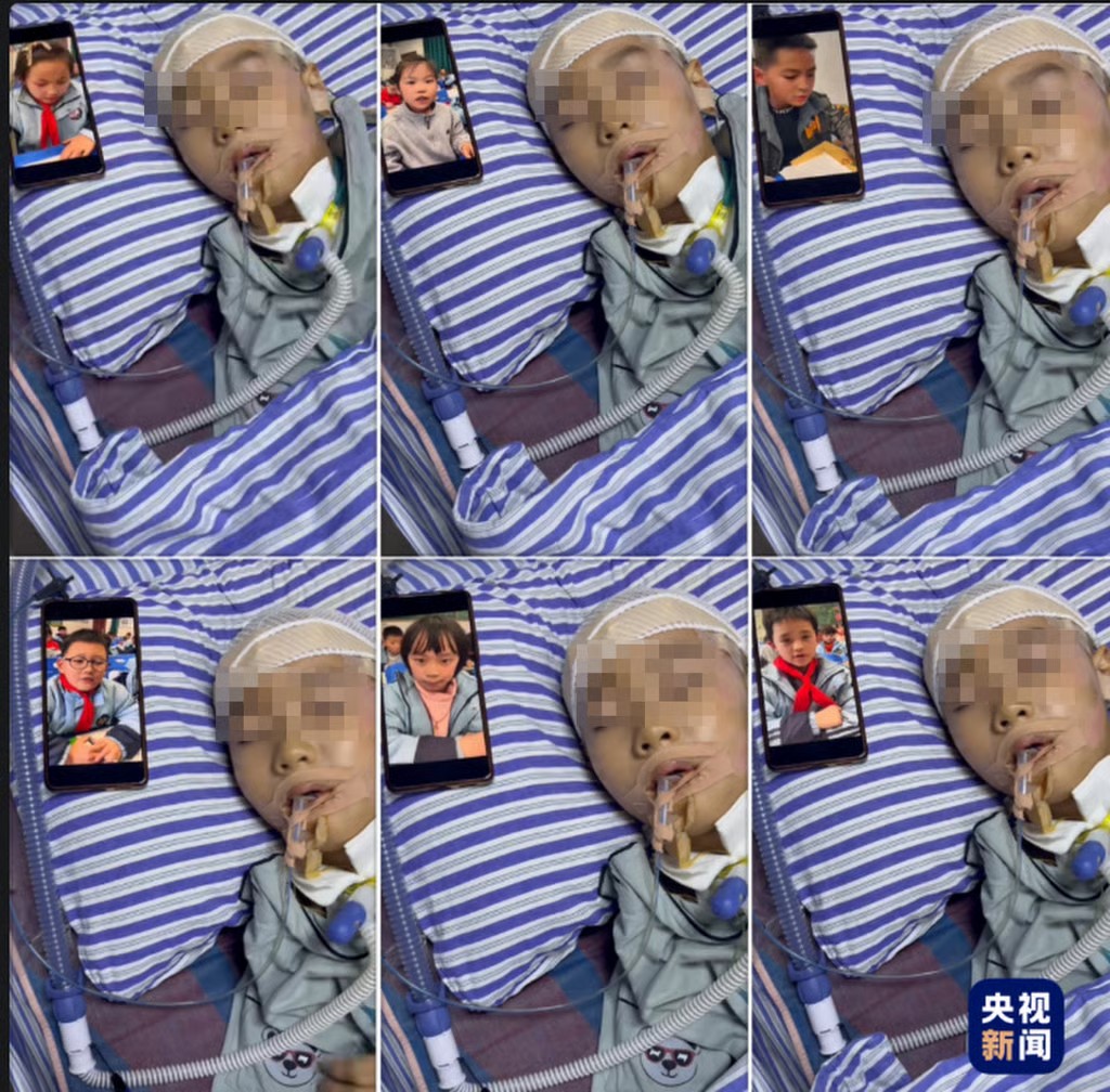 Cậu bé 8 tuổi lấy lại ý thức sau gần 2 tháng hôn mê nhờ nghe tiếng gọi của bạn bè - Ảnh 2.