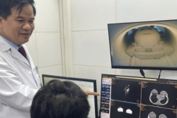 Bộ Y tế lên tiếng về việc BHYT không thanh toán X-quang dưới 6 phút