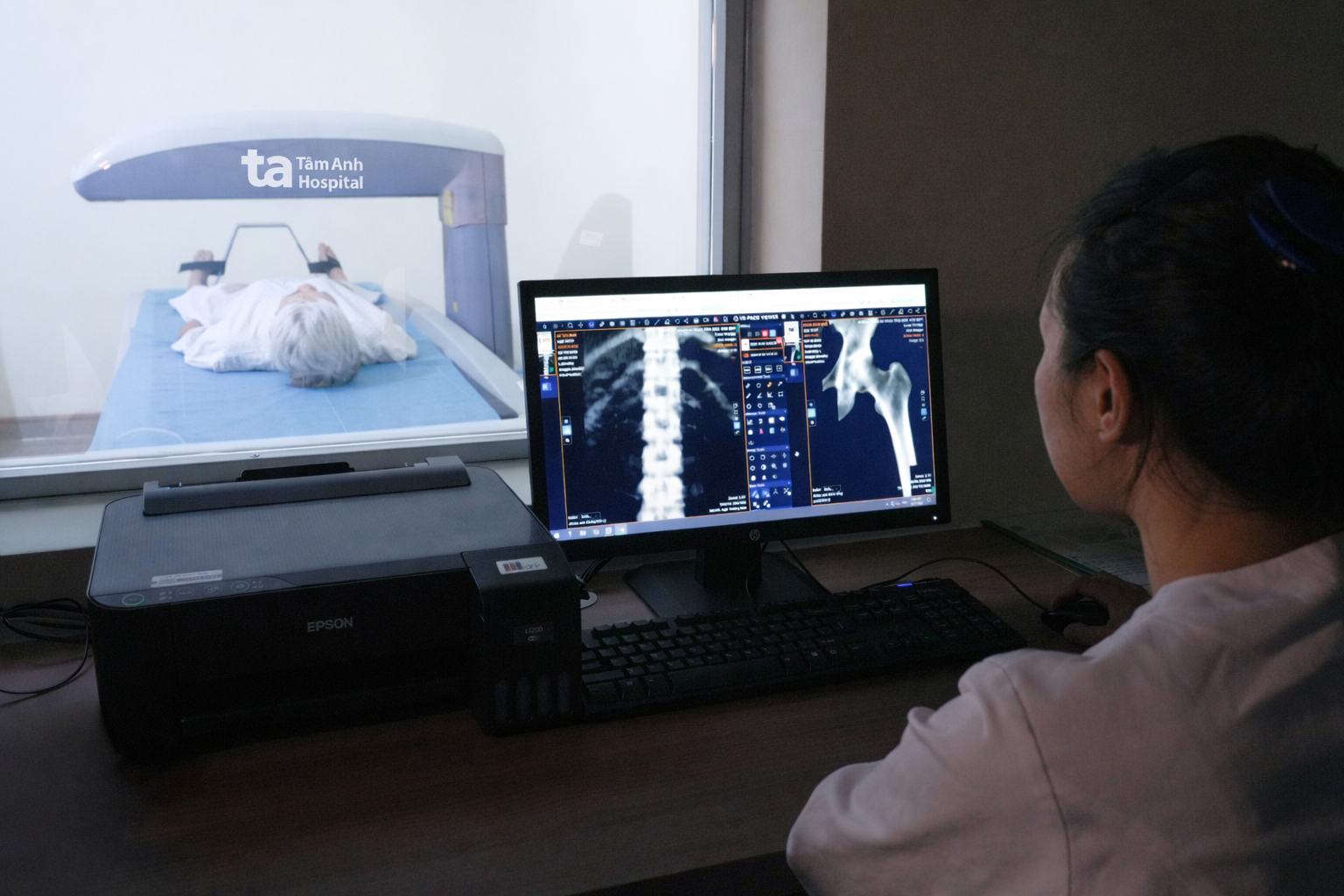 Hệ thống máy đo mật độ xương Prodigy DEXA Scanner (Mỹ) giúp tầm soát, phát hiện sớm dấu hiệu loãng xương với lượng phát xạ siêu thấp, không đau, không xâm lấn. Ảnh: BVĐK Tâm Anh