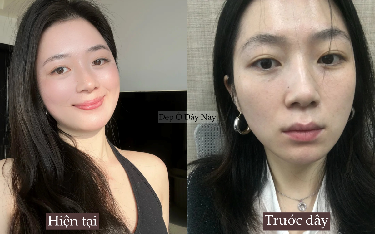 Ngoài 30 da còn đẹp hơn tuổi 20, tôi làm đúng 5 điều này mỗi ngày để 