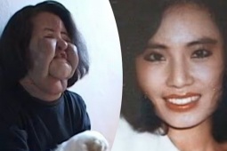 Đời bi kịch vì phẫu thuật thẩm mỹ của 'ca sĩ mặt quạt' Han Hye Kyung