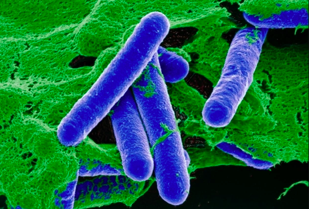 Bộ Y tế cảnh báo độc tố hủy hoại thần kinh trong đồ ủ chua, đóng hộp 1 Vi khuẩn hình que sinh botulinum là độc tố kịch độc, có thể gây tử vong chỉ với lượng nhỏ. Ảnh:Nature