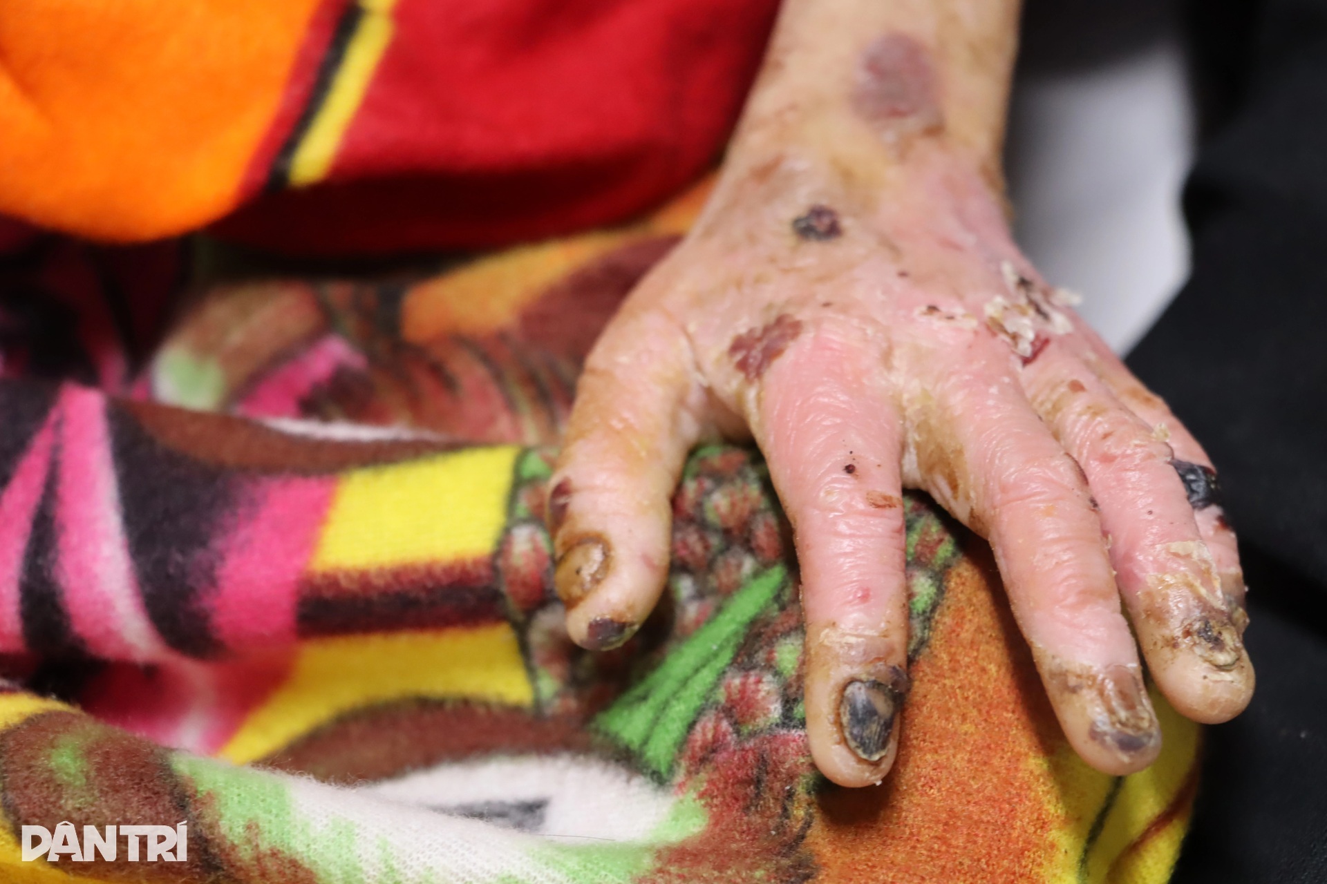 Tết không cần gì lớn lao, chỉ cần con khỏe lên một chút - 10 Tết không cần gì lớn lao, chỉ cần con khỏe lên một chút - 10