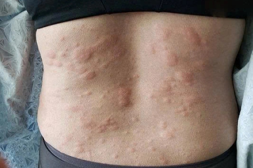 “Món lạ” trong mâm tất niên khiến người đàn ông cầu cứu bác sĩ - 2