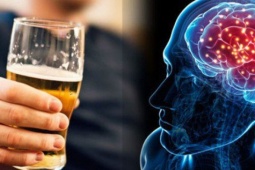 Uống mấy ly rượu mỗi ngày có thể tăng nguy cơ đột quỵ nghiêm trọng?