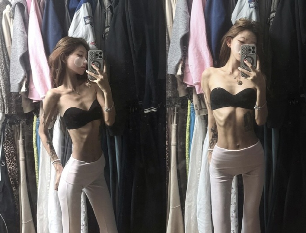 Con gái Choi Jin Sil: Kết hôn năm 23 tuổi, nghiện dao kéo làm đẹp - 4