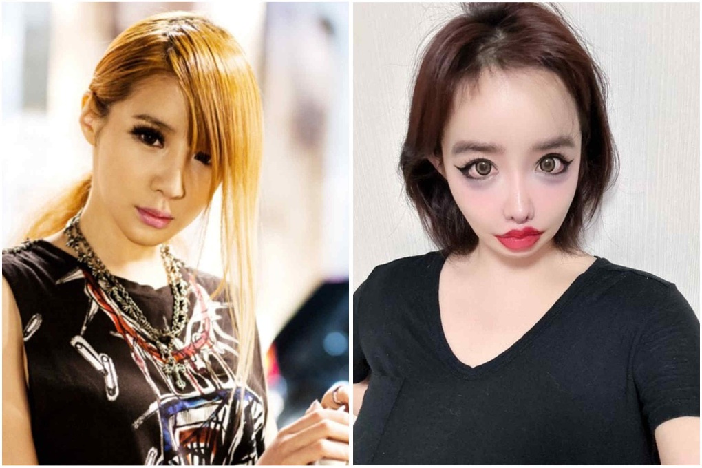 MC xinh đẹp Hàn Quốc bị biến dạng mặt nặng sau phẫu thuật thẩm mỹ cận Tết - 3