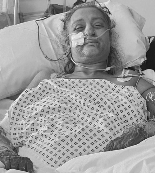 Bà Manjit Sangha trải qua 32 tuần điều trị tại bệnh viện. Ảnh: Kam Sangha