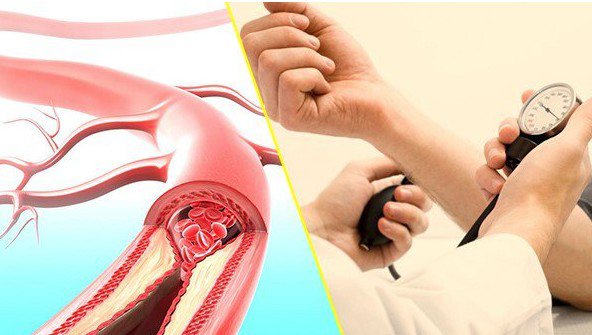 7 bệnh thường gặp sau kỳ nghỉ Tết, người Việt tuyệt đối không nên chủ quan 8 Ảnh minh họa,.