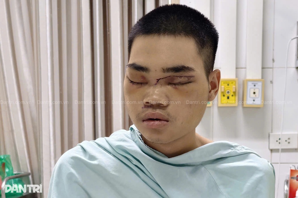 Con trai 24 tuổi gặp nạn, mờ mịt tương lai, mẹ đơn thân khẩn cầu sự giúp đỡ - 2