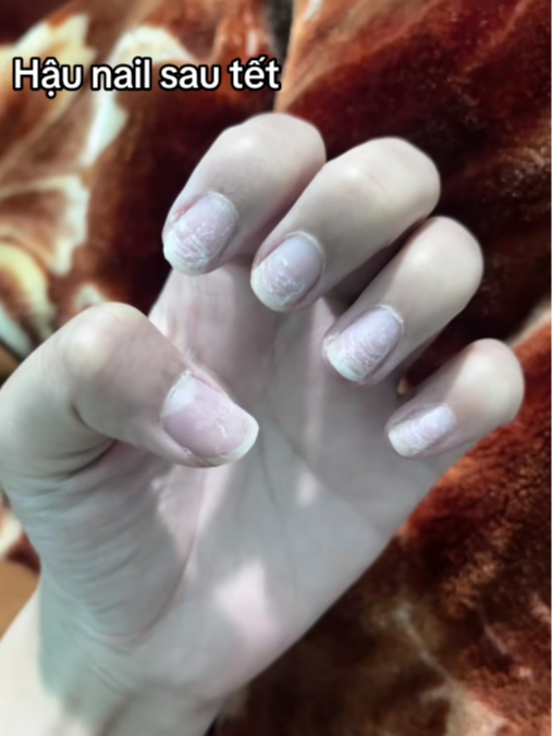 Cảnh tượng hãi hùng của những bộ nail sau Tết- Ảnh 4.