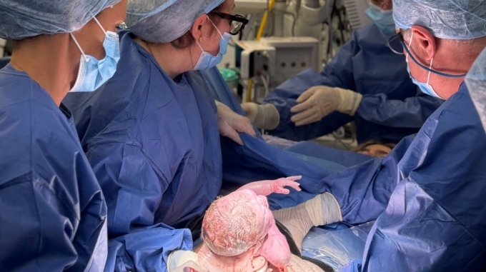 Khoảng khắc Hugo chào đời. Ảnh: Womb Transplant UK/PA