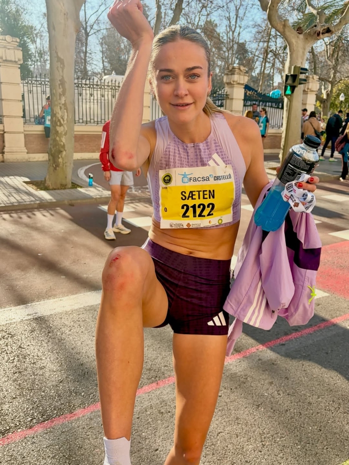 Amalie Saeten đăng ảnh bị trầy xước chân tay sau sự cố.