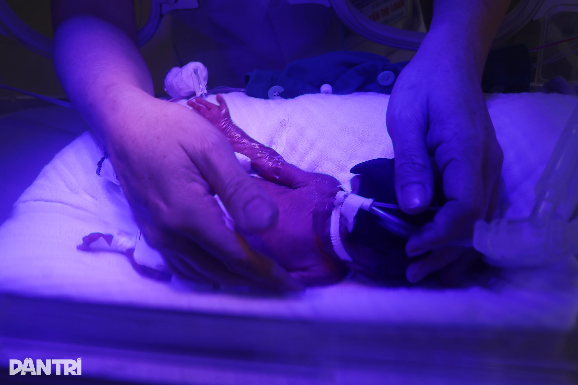 Nơi cuộc chiến giữ sinh mệnh trẻ sinh non được tính bằng giây - 2