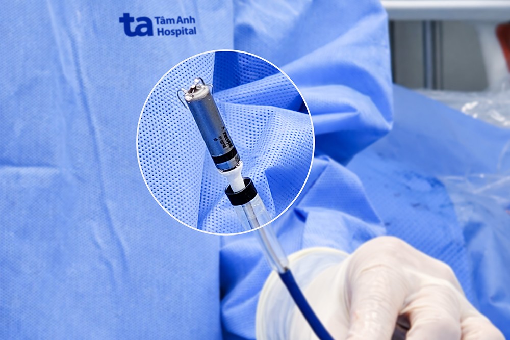 Bệnh viện Tâm Anh triển khai kỹ thuật tạo nhịp không dây thế hệ mới đầu tiên tại Việt Nam 6 Máy tạo nhịp không dây thế hệ mới Micra AV2 có kích thước chỉ bằng viên thuốc hình con nhộng, nặng khoảng 2g. Ảnh: BVĐK Tâm Anh