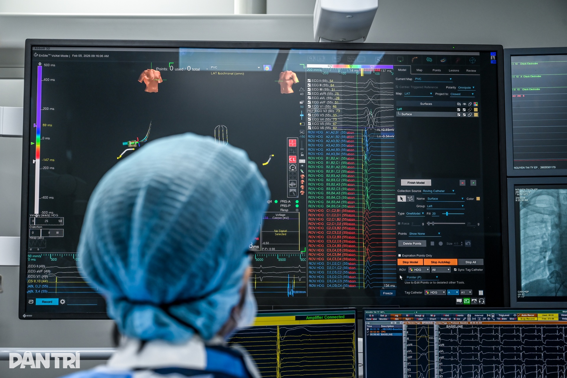 Hồi sinh nhịp tim bằng công nghệ lập bản đồ điện học thế hệ mới - 4