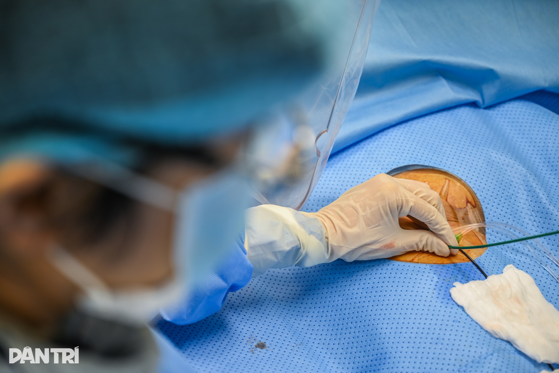 Hồi sinh nhịp tim bằng công nghệ lập bản đồ điện học thế hệ mới - 8