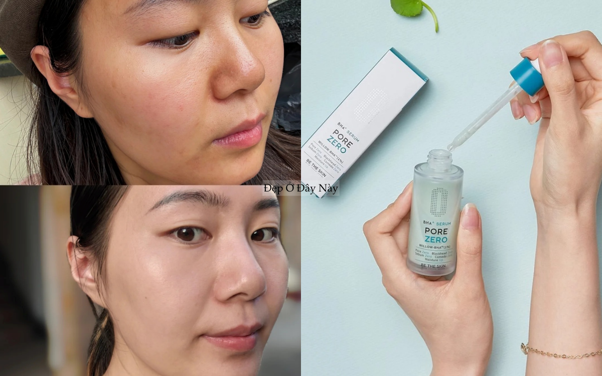 5 bước chăm da giúp lỗ chân lông to se khít, da mịn thấy rõ- Ảnh 1.