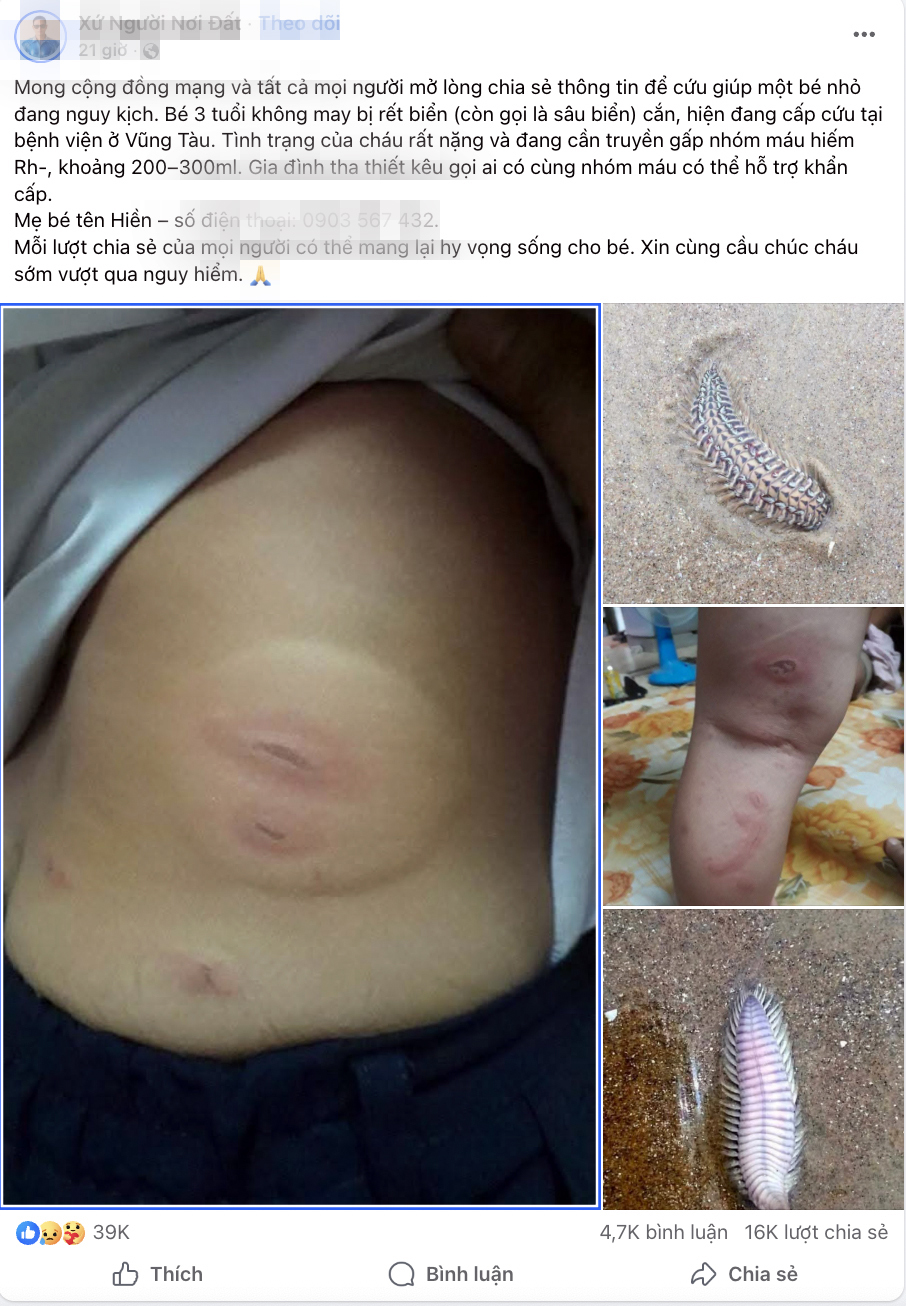 'Bé 3 tuổi bị rết biển cắn cần máu hiếm' gây 'bão' chia sẻ: Hóa ra là tin vịt 1 rết biển - Ảnh 1.