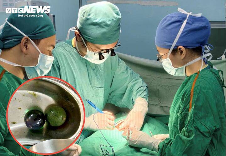 Ê-kíp thực hiện phẫu thuật mở ruột lấy dị vật cho bé gái 18 tháng tuổi.