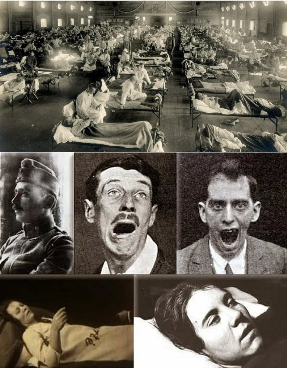 Bí ẩn về căn bệnh cướp đi 500.000 sinh mạng rồi đột ngột biến mất không một dấu vết- Ảnh 1. Bí ẩn về căn bệnh cướp đi 500.000 sinh mạng rồi đột ngột biến mất không một dấu vết- Ảnh 1.