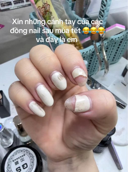 Cảnh tượng hãi hùng của những bộ nail sau Tết- Ảnh 2.