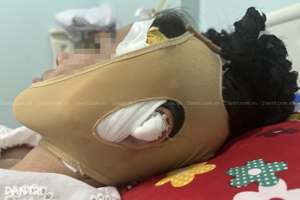 Cô gái biến dạng mặt sau tiêm filler ở TPHCM: Tôi gọi nhưng spa đóng cửa - 1