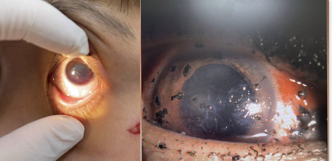 pháo nổ - Ảnh 1.