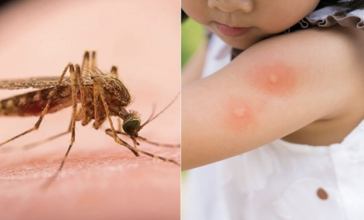 Du xuân an toàn: Cần làm gì khi bị côn trùng đốt? - Ảnh 1. Du xuân - Ảnh 1.