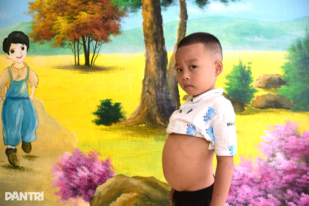 Mắc bệnh hiểm nghèo, bé trai vùng cao nguy cơ dang dở việc học - 2