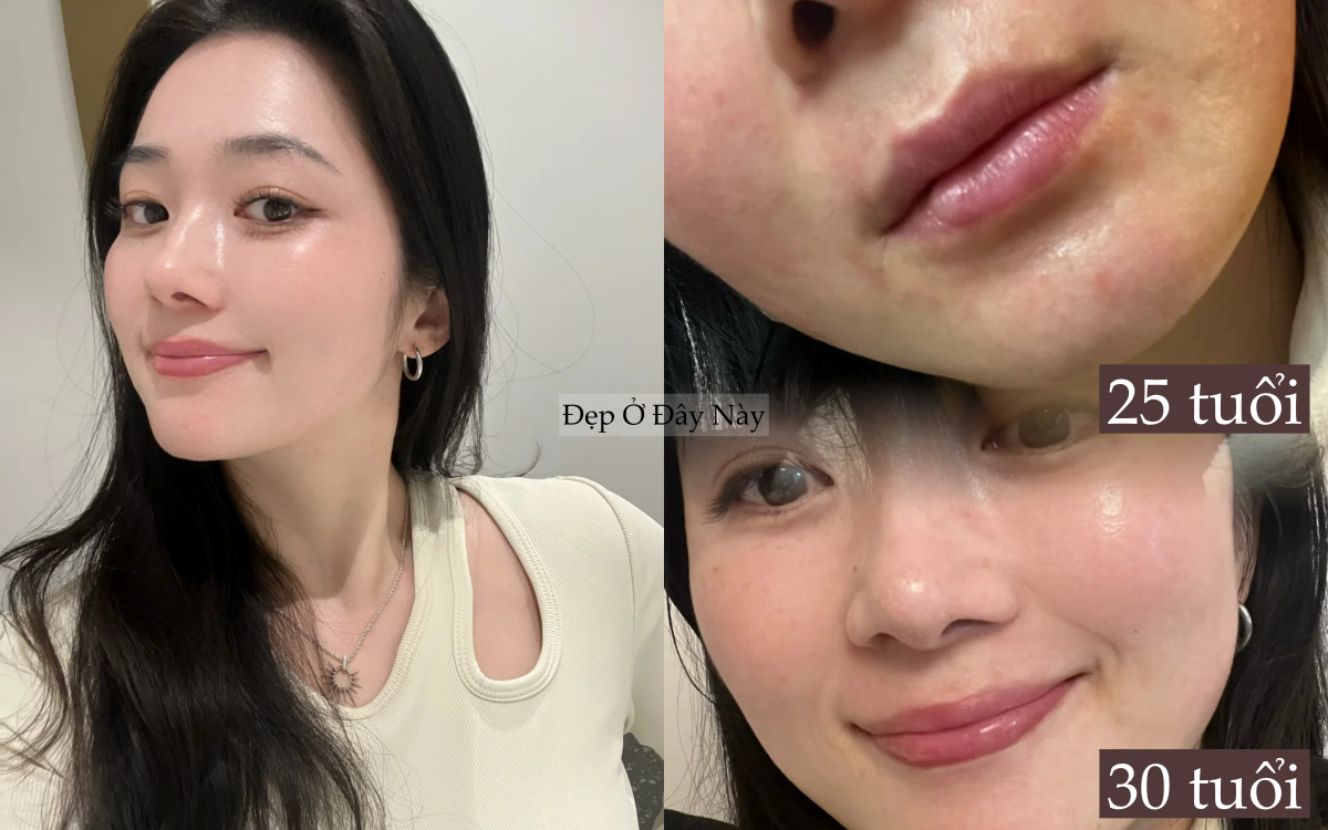 Ngoài 30 da còn đẹp hơn tuổi 20, tôi làm đúng 5 điều này mỗi ngày để 