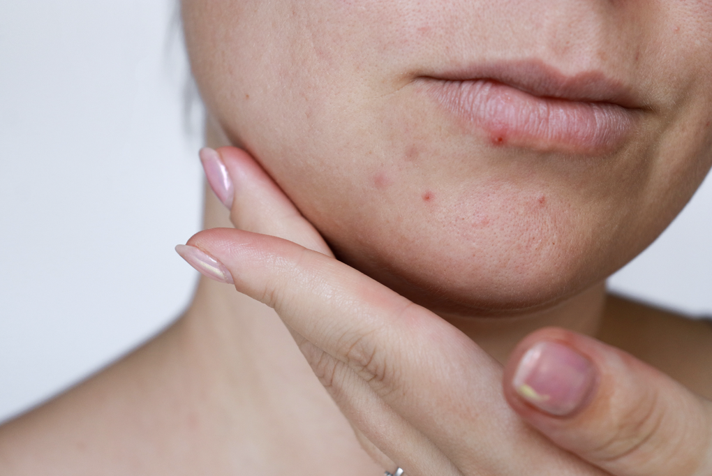 Nguyên tắc 4 đủ giúp da khỏe mạnh, căng bóng suốt dịp Tết - 1