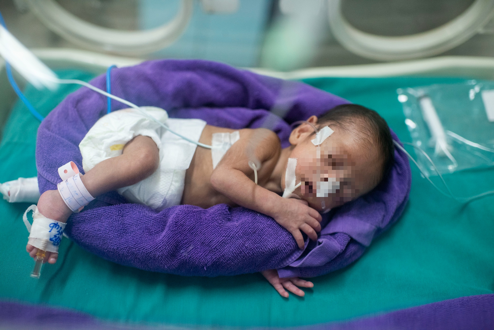 Những sinh linh bé nhỏ bắt đầu cuộc đời bằng một cuộc chiến - Ảnh 1.