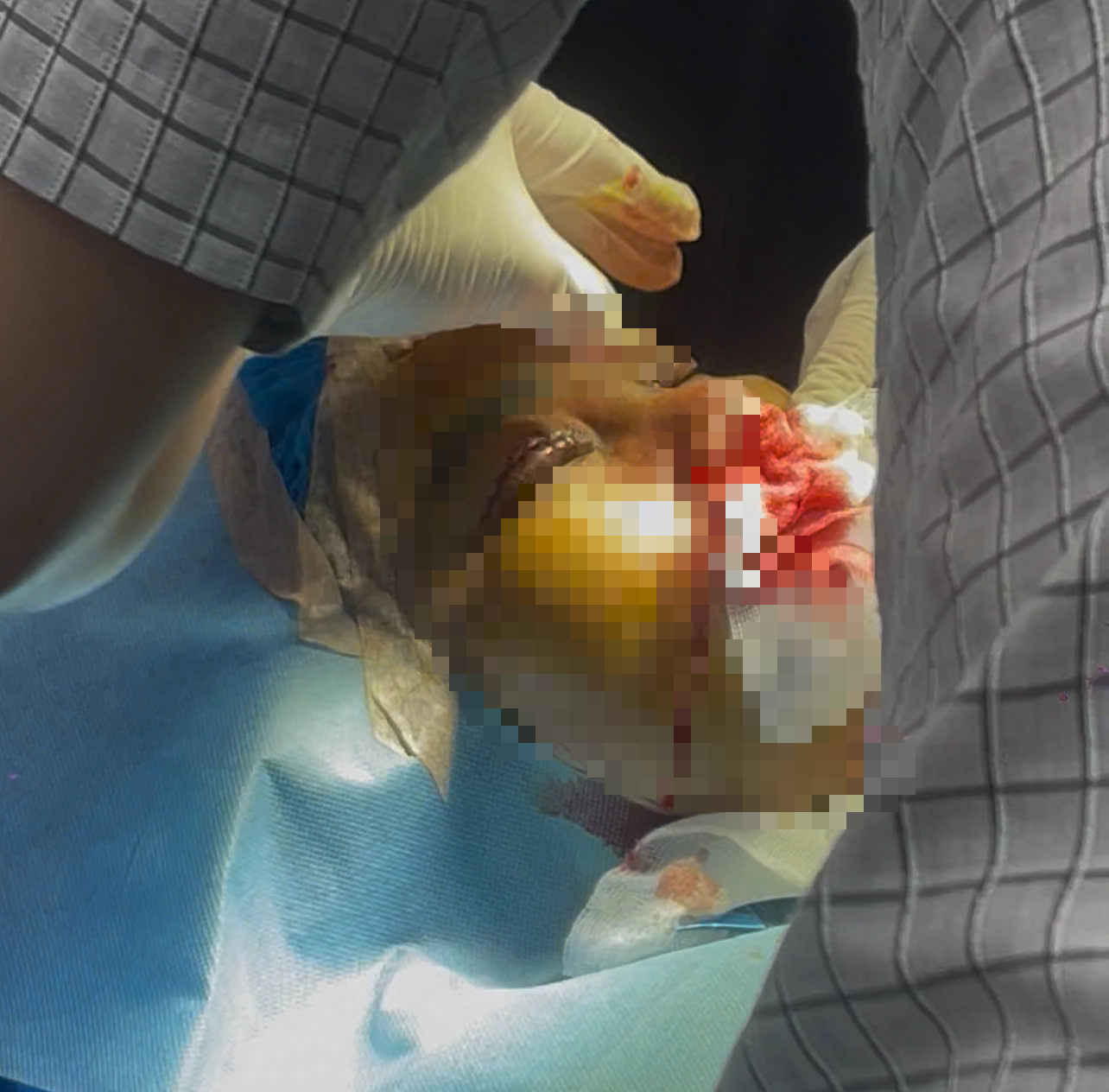 Phường Gò Vấp siết thẩm mỹ 'chui', khu CityLand là điểm 'nóng'- Ảnh 1.