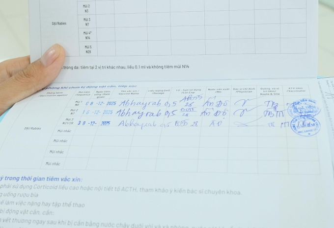 Một người dân chia sẻ lịch tiêm 3 mũi vaccine dự phòng bệnh dại trước phơi nhiễm. Ảnh: Hoàng Dương