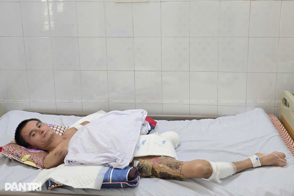 Từ trụ cột thành tàn phế: Lời cầu cứu xé lòng của người bố hai con - 1