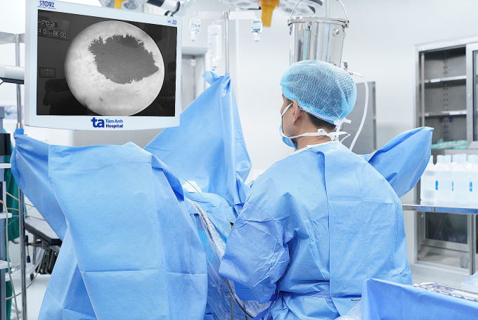 Êkíp bác sĩ phẫu thuật bóc nhân tuyến tiền liệt bằng laser Holmium cho ông Quang. Ảnh: Bệnh viện Đa khoa Tâm Anh