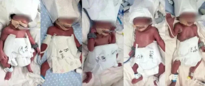 Năm em bé chào đời thiếu tháng, cân nặng từ từ 870 gram đến 1.030 gram, nhưng có chỉ số sinh tồn ở mức tương đối ổn định. Ảnh: Global Times