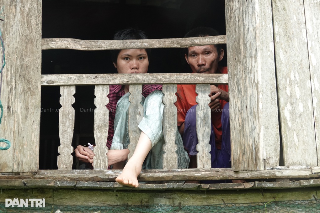 Người phụ nữ hỏng 1 mắt gồng mình nuôi chồng và con gái tâm thần - 2