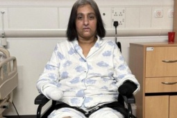 Chó liếm vết thương khiến người phụ nữ bị nhiễm trùng huyết mất tứ chi