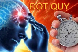 Người phụ nữ 65 tuổi ở Hà Nội bị đột quỵ thừa nhận một sai lầm mà rất nhiều người Việt mắc phải